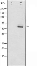 AF6102 at 1/100 staining Mouse lung tissue by IHC-P. The sample was formaldehyde fixed and a heat mediated antigen retrieval step in citrate buffer was performed. The sample was then blocked and incubated with the antibody for 1.5 hours at 22¡ãC. An HRP conjugated goat anti-rabbit antibody was used as the secondary