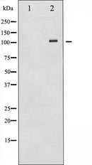 AF6103 at 1/100 staining Rat kidney tissue by IHC-P. The sample was formaldehyde fixed and a heat mediated antigen retrieval step in citrate buffer was performed. The sample was then blocked and incubated with the antibody for 1.5 hours at 22¡ãC. An HRP conjugated goat anti-rabbit antibody was used as the secondary