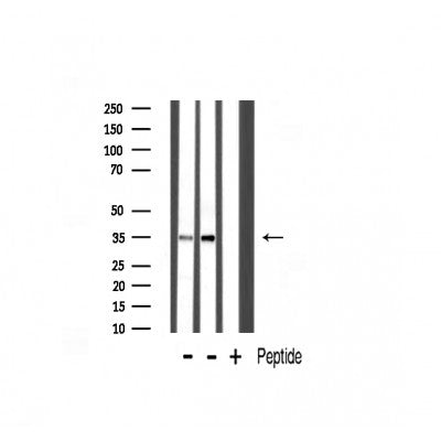 Western blot analysis of Synaptophysin expression in various lysates
