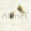 Western blot analysis of extracts from Mouse brain, using Tyrosine Hydroxylase Antibody. Lane 1 was treated with the blocking peptide.
