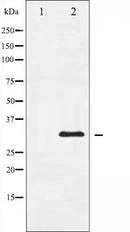 AF6118 staining 293 by IF/ICC. The sample were fixed with PFA and permeabilized in 0.1% Triton X-100,then blocked in 10% serum for 45 minutes at 25¡ãC. The primary antibody was diluted at 1/200 and incubated with the sample for 1 hour at 37¡ãC. An  Alexa Fluor 594 conjugated goat anti-rabbit IgG (H+L) Ab, diluted at 1/600, was used as the secondary antibod