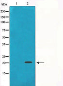 Western blot analysis on HT29 cell lysate using Gamma-synuclein Antibody,The lane on the left is treated with the antigen-specific peptide.