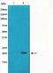 Western blot analysis on HT29 cell lysate using Gamma-synuclein Antibody,The lane on the left is treated with the antigen-specific peptide.