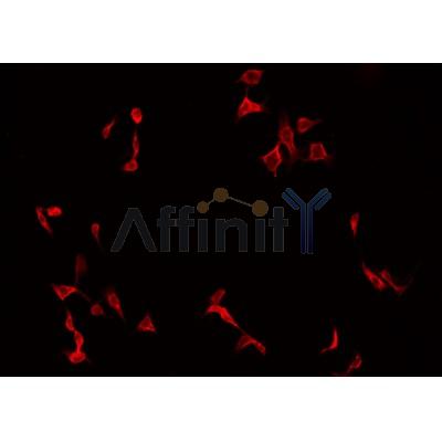 AF0258 staining HT29 by IF/ICC. The sample were fixed with PFA and permeabilized in 0.1% Triton X-100,then blocked in 10% serum for 45 minutes at 25¡ãC. The primary antibody was diluted at 1/200 and incubated with the sample for 1 hour at 37¡ãC. An  Alexa Fluor 594 conjugated goat anti-rabbit IgG (H+L) Ab, diluted at 1/600, was used as the secondary antibod