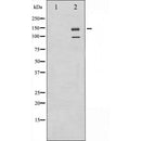 AF6124 at 1/100 staining Human liver cancer tissue by IHC-P. The sample was formaldehyde fixed and a heat mediated antigen retrieval step in citrate buffer was performed. The sample was then blocked and incubated with the antibody for 1.5 hours at 22¡ãC. An HRP conjugated goat anti-rabbit antibody was used as the secondary