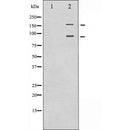 Western blot analysis of extracts from HuvEc, using IGF1R Antibody. Lane 1 was treated with the blocking peptide.