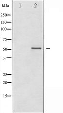 AF6131 at 1/100 staining Rat heart tissue by IHC-P. The sample was formaldehyde fixed and a heat mediated antigen retrieval step in citrate buffer was performed. The sample was then blocked and incubated with the antibody for 1.5 hours at 22¡ãC. An HRP conjugated goat anti-rabbit antibody was used as the secondary