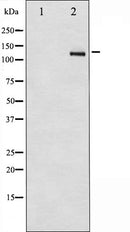 Western blot analysis of PDGFR beta expression in TNF-a treated Jurkat whole cell lysates,The lane on the left is treated with the antigen-specific peptide.