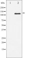 Western blot analysis of PDGFRb expression in HepG2 whole cell lysates,The lane on the left is treated with the antigen-specific peptide.