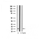 AF6135 at 1/100 staining Human breast cancer tissue by IHC-P. The sample was formaldehyde fixed and a heat mediated antigen retrieval step in citrate buffer was performed. The sample was then blocked and incubated with the antibody for 1.5 hours at 22¡ãC. An HRP conjugated goat anti-rabbit antibody was used as the secondary