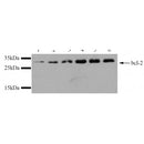 Western blot analysis of extracts from various samples, using BCL-2 Antibody. 
Lane 1: 293 cells treated with the blocking peptide.
Lane 2: 293 cells;
Lane 3: mouse brain tissue;
Lane 4: HuvEc cells.