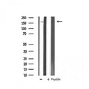 AF6152 staining HepG2 by IF/ICC. The sample were fixed with PFA and permeabilized in 0.1% Triton X-100,then blocked in 10% serum for 45 minutes at 25¡ãC. The primary antibody was diluted at 1/200 and incubated with the sample for 1 hour at 37¡ãC. An  Alexa Fluor 594 conjugated goat anti-rabbit IgG (H+L) Ab, diluted at 1/600, was used as the secondary antibod
