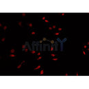 Western blot analysis of extracts from HUVEC, using FGFR1 Antibody. Lane 1 was treated with the blocking peptide.