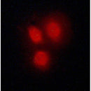 Western blot analysis of extracts from B16F10, using Vitamin D Receptor Antibody. Lane 1 was treated with the blocking peptide.