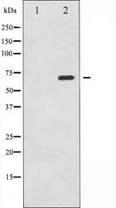AF6160 at 1/100 staining Human breast cancer tissue by IHC-P. The sample was formaldehyde fixed and a heat mediated antigen retrieval step in citrate buffer was performed. The sample was then blocked and incubated with the antibody for 1.5 hours at 22¡ãC. An HRP conjugated goat anti-rabbit antibody was used as the secondary