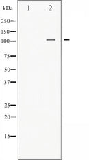 Western blot analysis of Integrin alpha4 expression in PMA treated Jurkat whole cell lysates,The lane on the left is treated with the antigen-specific peptide.