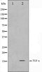 Western blot analysis on COS7 cell lysate using TGF alpha Antibody,The lane on the left is treated with the antigen-specific peptide.