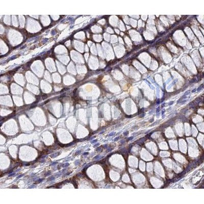 IHC analysis of Human gastric tissue, using TGF alpha Antibody at 1/100