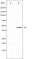 AF6167 at 1/100 staining Human Melanoma tissue by IHC-P. The sample was formaldehyde fixed and a heat mediated antigen retrieval step in citrate buffer was performed. The sample was then blocked and incubated with the antibody for 1.5 hours at 22¡ãC. An HRP conjugated goat anti-rabbit antibody was used as the secondary