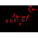 Western blot analysis of extracts from Mouse lung, using Ezrin Antibody. Lane 1 was treated with the blocking peptide.