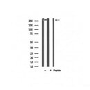 Western blot analysis of extracts from HepG2, using Filamin A Antibody. Lane 1 was treated with the blocking peptide.
