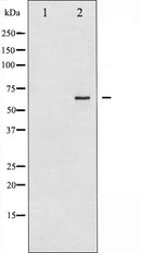 AF6224 at 1/100 staining Human melanoma tissue by IHC-P. The sample was formaldehyde fixed and a heat mediated antigen retrieval step in citrate buffer was performed. The sample was then blocked and incubated with the antibody for 1.5 hours at 22¡ãC. An HRP conjugated goat anti-rabbit antibody was used as the secondary