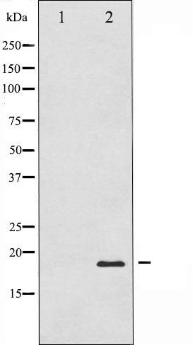 AF6430 staining COS7 by IF/ICC. The sample were fixed with PFA and permeabilized in 0.1% Triton X-100,then blocked in 10% serum for 45 minutes at 25¡ãC. The primary antibody was diluted at 1/200 and incubated with the sample for 1 hour at 37¡ãC. An  Alexa Fluor 594 conjugated goat anti-rabbit IgG (H+L) Ab, diluted at 1/600, was used as the secondary antibod