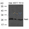 Western blot analysis of extract from Hela, MCF and PC12 cells using Rab5 Antibody