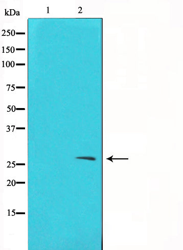 Western blot analysis on A549 cell lysate using TIMP2 Antibody,The lane on the left is treated with the antigen-specific peptide.