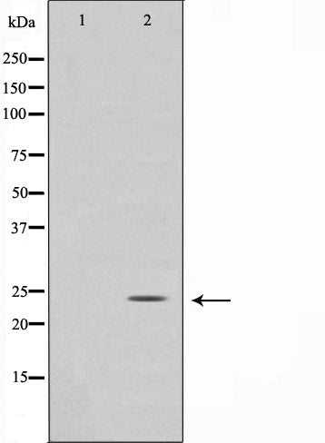 Western blot analysis on HuvEc cell lysate using TIMP3 Antibody,The lane on the left is treated with the antigen-specific peptide.