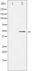 AF6176 staining Hela by IF/ICC. The sample were fixed with PFA and permeabilized in 0.1% Triton X-100,then blocked in 10% serum for 45 minutes at 25¡ãC. The primary antibody was diluted at 1/200 and incubated with the sample for 1 hour at 37¡ãC. An  Alexa Fluor 594 conjugated goat anti-rabbit IgG (H+L) Ab, diluted at 1/600, was used as the secondary antibod