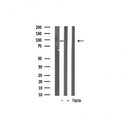Western blot analysis of extracts from Mouse brain, using VAV1 Antibody. Lane 1 was treated with the blocking peptide.