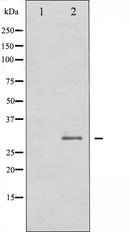 AF6183 at 1/100 staining Human liver tissue by IHC-P. The sample was formaldehyde fixed and a heat mediated antigen retrieval step in citrate buffer was performed. The sample was then blocked and incubated with the antibody for 1.5 hours at 22¡ãC. An HRP conjugated goat anti-rabbit antibody was used as the secondary