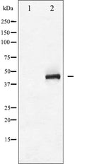 AF6185 staining Hela by IF/ICC. The sample were fixed with PFA and permeabilized in 0.1% Triton X-100,then blocked in 10% serum for 45 minutes at 25¡ãC. The primary antibody was diluted at 1/200 and incubated with the sample for 1 hour at 37¡ãC. An  Alexa Fluor 594 conjugated goat anti-rabbit IgG (H+L) Ab, diluted at 1/600, was used as the secondary antibod