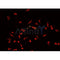 AF0266 staining MCF-7 cells by IF/ICC. The sample were fixed with PFA and permeabilized in 0.1% Triton X-100,then blocked in 10% serum for 45 minutes at 25¡ãC. The primary antibody was diluted at 1/200 and incubated with the sample for 1 hour at 37¡ãC. An  Alexa Fluor 594 conjugated goat anti-rabbit IgG (H+L) antibody(Cat.