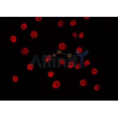 AF0266 staining 293 by IF/ICC. The sample were fixed with PFA and permeabilized in 0.1% Triton X-100,then blocked in 10% serum for 45 minutes at 25¡ãC. The primary antibody was diluted at 1/200 and incubated with the sample for 1 hour at 37¡ãC. An  Alexa Fluor 594 conjugated goat anti-rabbit IgG (H+L) Ab, diluted at 1/600, was used as the secondary antibod