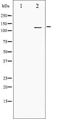Western blot analysis of PDGFRa expression in Jurkat whole cell lysates,The lane on the left is treated with the antigen-specific peptide.