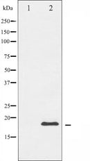 AF6193 at 1/100 staining Mouse testis tissue by IHC-P. The sample was formaldehyde fixed and a heat mediated antigen retrieval step in citrate buffer was performed. The sample was then blocked and incubated with the antibody for 1.5 hours at 22¡ãC. An HRP conjugated goat anti-rabbit antibody was used as the secondary