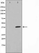 AF6198 at 1/100 staining Rat brain tissue by IHC-P. The sample was formaldehyde fixed and a heat mediated antigen retrieval step in citrate buffer was performed. The sample was then blocked and incubated with the antibody for 1.5 hours at 22¡ãC. An HRP conjugated goat anti-rabbit antibody was used as the secondary