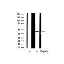 Western blot analysis of extracts from VERO, using JunD Antibody. The lane on the left was treated with blocking peptide.