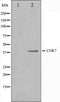 Western blot analysis on HeLa cell lysate using CDK7 Antibody,The lane on the left is treated with the antigen-specific peptide.