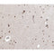 AF0267 at 1/100 staining human brain tissue sections by IHC-P. The tissue was formaldehyde fixed and a heat mediated antigen retrieval step in citrate buffer was performed. The tissue was then blocked and incubated with the antibody for 1.5 hours at 22¡ãC. An HRP conjugated goat anti-rabbit antibody was used as the secondary