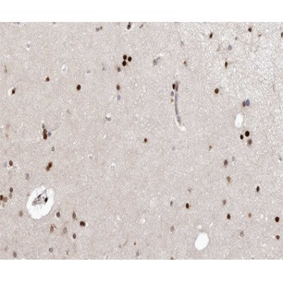 AF0267 at 1/100 staining human brain tissue sections by IHC-P. The tissue was formaldehyde fixed and a heat mediated antigen retrieval step in citrate buffer was performed. The tissue was then blocked and incubated with the antibody for 1.5 hours at 22¡ãC. An HRP conjugated goat anti-rabbit antibody was used as the secondary