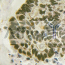 Western blot analysis of extracts from 3t3, using C/EBP-beta Antibody. Lane 1 was treated with the blocking peptide.