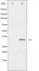 AF6203 at 1/100 staining Human spleen tissue by IHC-P. The sample was formaldehyde fixed and a heat mediated antigen retrieval step in citrate buffer was performed. The sample was then blocked and incubated with the antibody for 1.5 hours at 22¡ãC. An HRP conjugated goat anti-rabbit antibody was used as the secondary