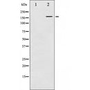 AF6204 staining A-431? cells by IF/ICC. The sample were fixed with PFA and permeabilized in 0.1% Triton X-100,then blocked in 10% serum for 45 minutes at 25¡ãC. The primary antibody was diluted at 1/200 and incubated with the sample for 1 hour at 37¡ãC. An  Alexa Fluor 594 conjugated goat anti-rabbit IgG (H+L) antibody(Cat.
