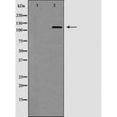 AF6206 at 1/100 staining Mouse muscle tissue by IHC-P. The sample was formaldehyde fixed and a heat mediated antigen retrieval step in citrate buffer was performed. The sample was then blocked and incubated with the antibody for 1.5 hours at 22¡ãC. An HRP conjugated goat anti-rabbit antibody was used as the secondary