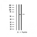 AF6207 at 1/100 staining Mouse intestine tissue by IHC-P. The sample was formaldehyde fixed and a heat mediated antigen retrieval step in citrate buffer was performed. The sample was then blocked and incubated with the antibody for 1.5 hours at 22¡ãC. An HRP conjugated goat anti-rabbit antibody was used as the secondary
