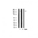 Western blot analysis of extracts from B16F10, using PLCG1 Antibody. Lane 1 was treated with the blocking peptide.
