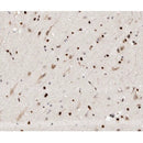 AF0268 at 1/100 staining human brain tissue sections by IHC-P. The tissue was formaldehyde fixed and a heat mediated antigen retrieval step in citrate buffer was performed. The tissue was then blocked and incubated with the antibody for 1.5 hours at 22¡ãC. An HRP conjugated goat anti-rabbit antibody was used as the secondary